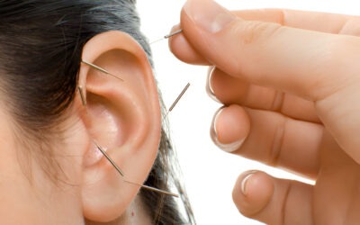 Acupuntura: La Milenaria Práctica que Equilibra Cuerpo y Mente